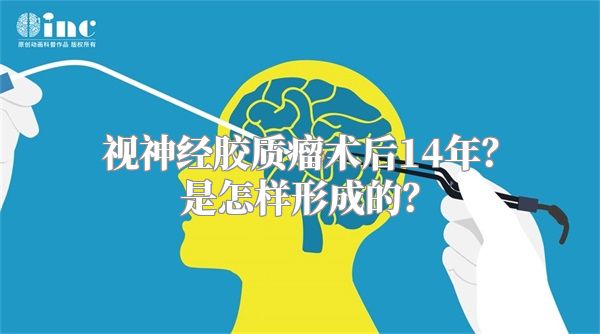 视神经胶质瘤术后14年？是怎样形成的？