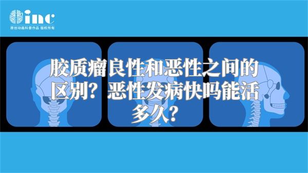 胶质瘤良性和恶性之间的区别？恶性发病快吗能活多久？