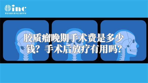 胶质瘤晚期手术费是多少钱？手术后放疗有用吗？