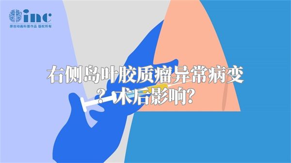 右侧岛叶胶质瘤异常病变？术后影响？