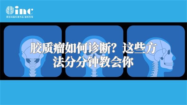 胶质瘤如何诊断？这些方法分分钟教会你