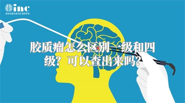 胶质瘤怎么区别一级和四级？可以查出来吗？