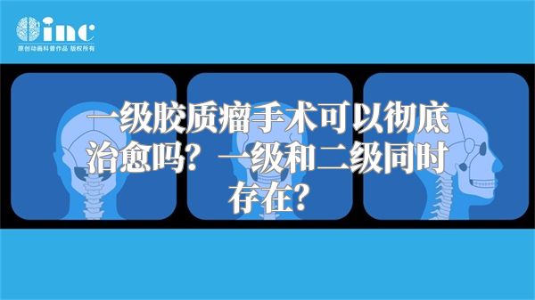 一级胶质瘤手术可以彻底治愈吗？一级和二级同时存在？