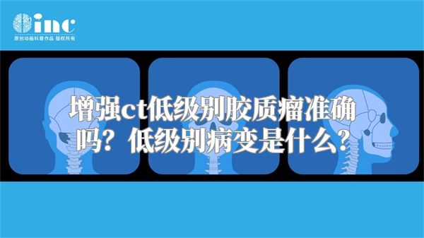 增强ct低级别胶质瘤准确吗？低级别病变是什么？