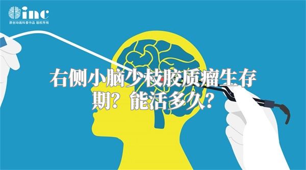 右侧小脑少枝胶质瘤生存期？能活多久？