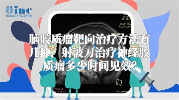 脑胶质瘤靶向治疗方法有几种，射波刀治疗神经胶质瘤多少时间见效？