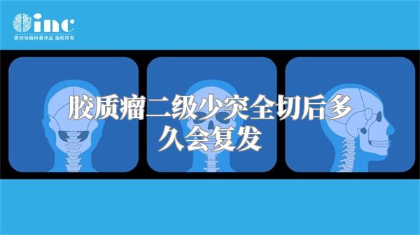 胶质瘤二级少突全切后多久会复发