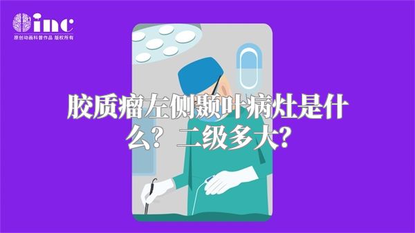 胶质瘤左侧颞叶病灶是什么？二级多大？