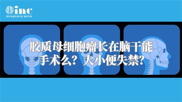 胶质母细胞瘤长在脑干能手术么？大小便失禁？