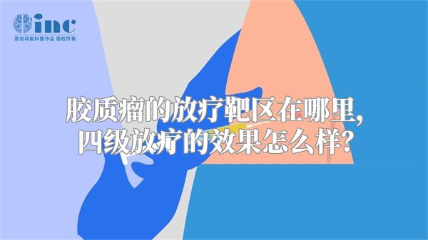 胶质瘤的放疗靶区在哪里，四级放疗的效果怎么样？