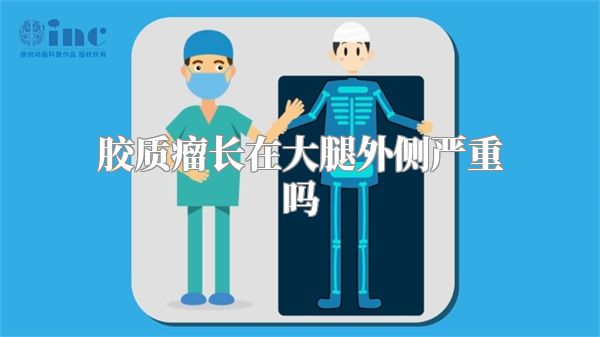 胶质瘤长在大腿外侧严重吗