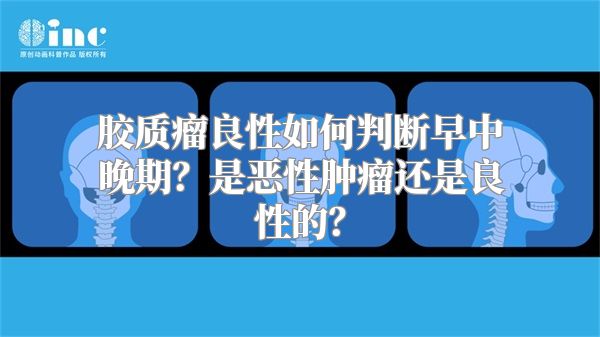 胶质瘤良性如何判断早中晚期？是恶性肿瘤还是良性的？