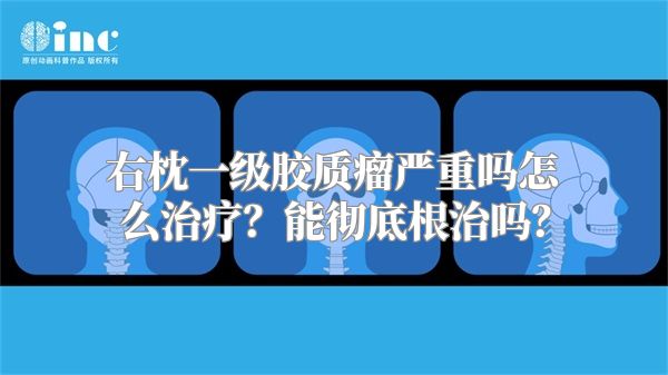 右枕一级胶质瘤严重吗怎么治疗？能彻底根治吗？