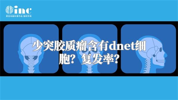 少突胶质瘤含有dnet细胞？复发率？