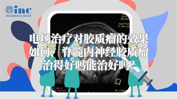 电场治疗对胶质瘤的效果如何，脊髓内神经胶质瘤治得好吗能治好吗？