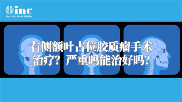 右侧额叶占位胶质瘤手术治疗？严重吗能治好吗？