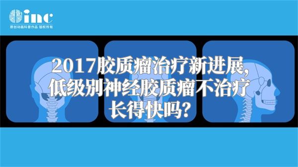 2017胶质瘤治疗新进展，低级别神经胶质瘤不治疗长得快吗？