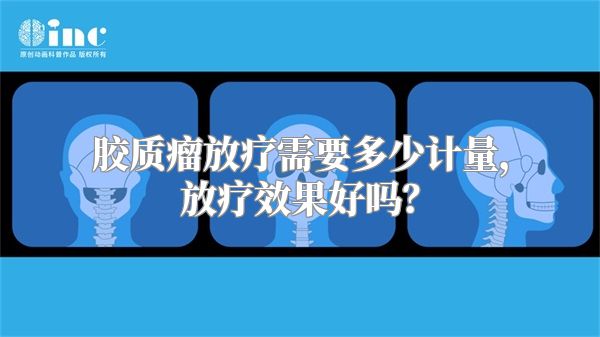 胶质瘤放疗需要多少计量，放疗效果好吗？