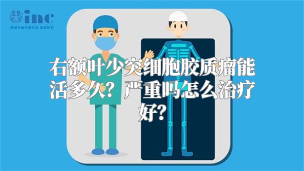 右额叶少突细胞胶质瘤能活多久？严重吗怎么治疗好？