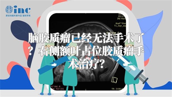 脑胶质瘤已经无法手术了？右侧额叶占位胶质瘤手术治疗？