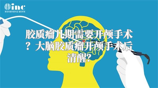 胶质瘤几期需要开颅手术？大脑胶质瘤开颅手术后清醒？