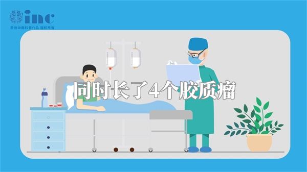 同时长了4个胶质瘤