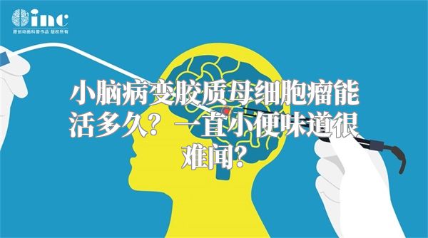 小脑病变胶质母细胞瘤能活多久？一直小便味道很难闻？