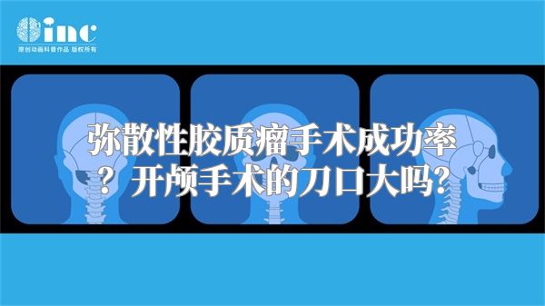 弥散性胶质瘤手术成功率？开颅手术的刀口大吗？