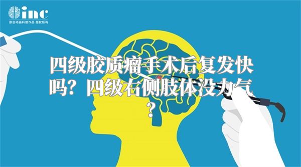 四级胶质瘤手术后复发快吗？四级右侧肢体没力气？