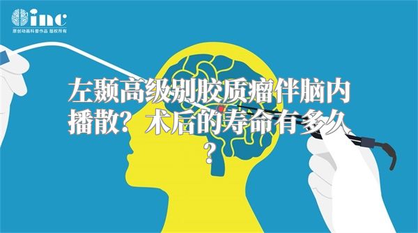 左颞高级别胶质瘤伴脑内播散？术后的寿命有多久？