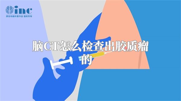 脑CT怎么检查出胶质瘤的    