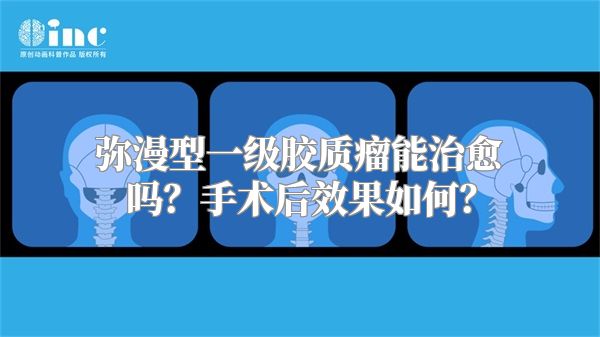 弥漫型一级胶质瘤能治愈吗？手术后效果如何？