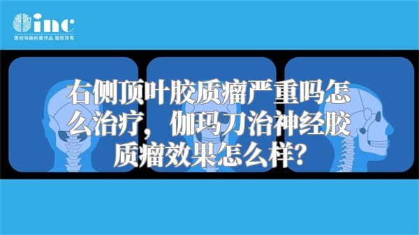 右侧顶叶胶质瘤严重吗怎么治疗，伽玛刀治神经胶质瘤效果怎么样？