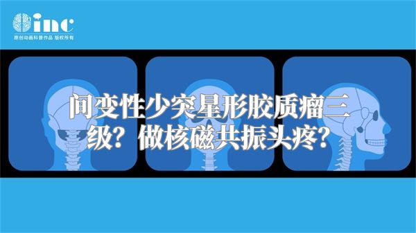 间变性少突星形胶质瘤三级？做核磁共振头疼？