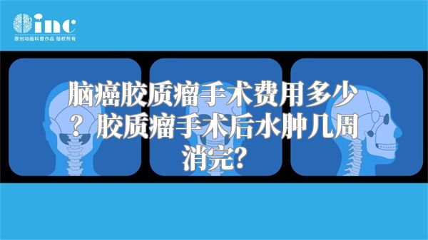 脑癌胶质瘤手术费用多少？胶质瘤手术后水肿几周消完？