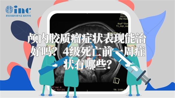 颅内胶质瘤症状表现能治好吗？4级死亡前一周症状有哪些？