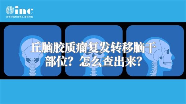 丘脑胶质瘤复发转移脑干部位？怎么查出来？