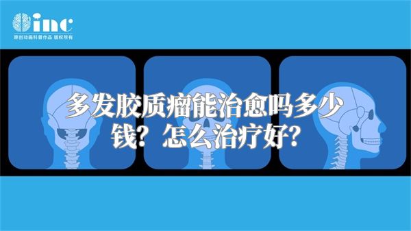 多发胶质瘤能治愈吗多少钱？怎么治疗好？