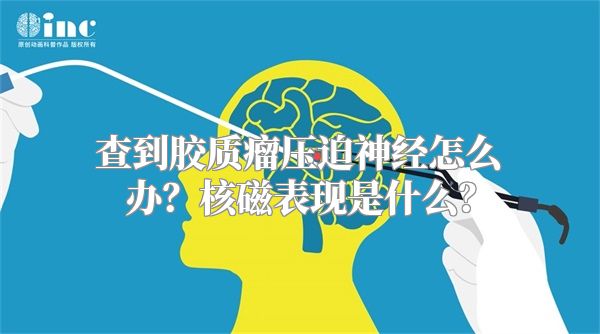 查到胶质瘤压迫神经怎么办？核磁表现是什么？