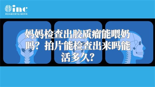 妈妈检查出胶质瘤能喂奶吗？拍片能检查出来吗能活多久？