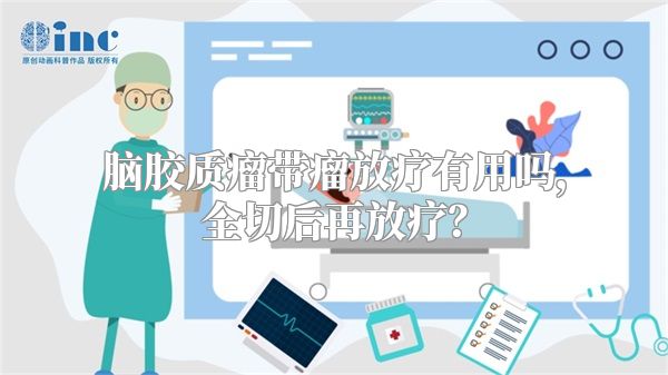 脑胶质瘤带瘤放疗有用吗，全切后再放疗？