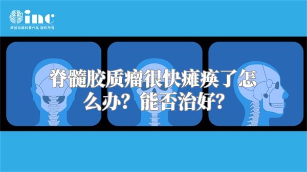 脊髓胶质瘤很快瘫痪了怎么办？能否治好？