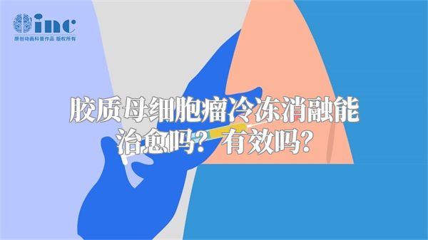 胶质母细胞瘤冷冻消融能治愈吗？有效吗？