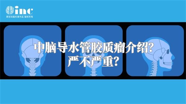 中脑导水管胶质瘤介绍？严不严重？