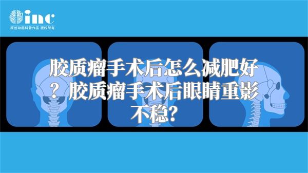 胶质瘤手术后怎么减肥好？胶质瘤手术后眼睛重影不稳？