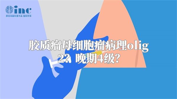 胶质瘤母细胞瘤病理olig2？晚期4级？