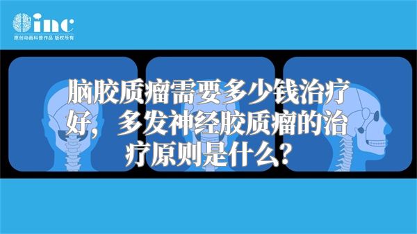 脑胶质瘤需要多少钱治疗好，多发神经胶质瘤的治疗原则是什么？