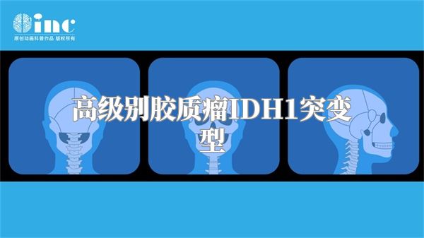 高级别胶质瘤IDH1突变型