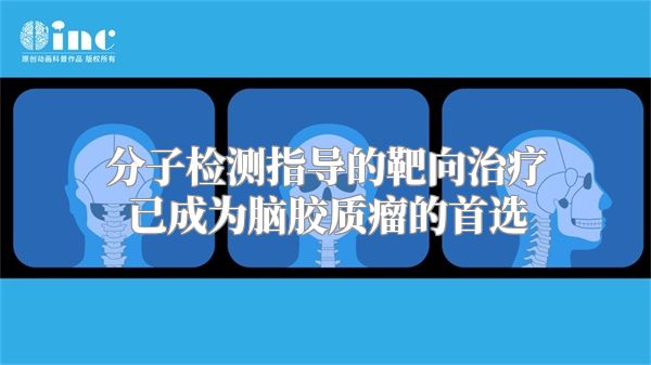 分子检测指导的靶向治疗已成为脑胶质瘤的首选