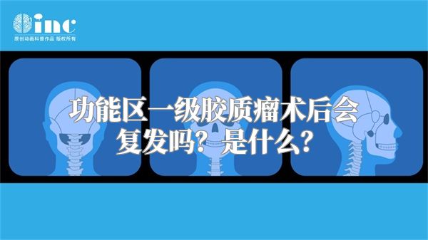 功能区一级胶质瘤术后会复发吗？是什么？